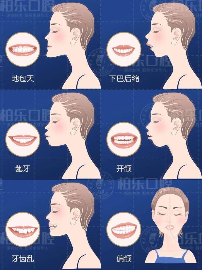 The principle of dental correction