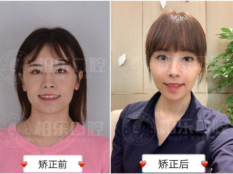 The principle of dental correction