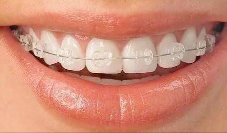 The principle of dental correction