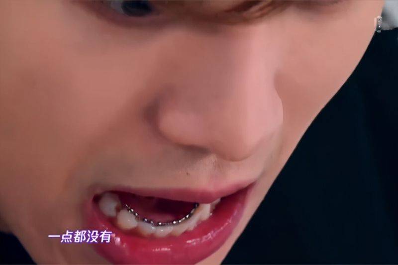 The principle of dental correction