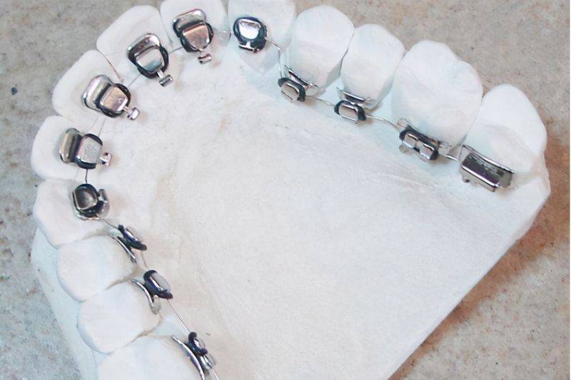 The principle of dental correction