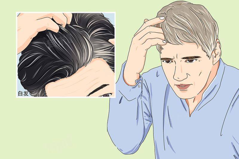 A cure for white hair