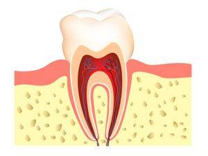 The cost of a vivo root tube