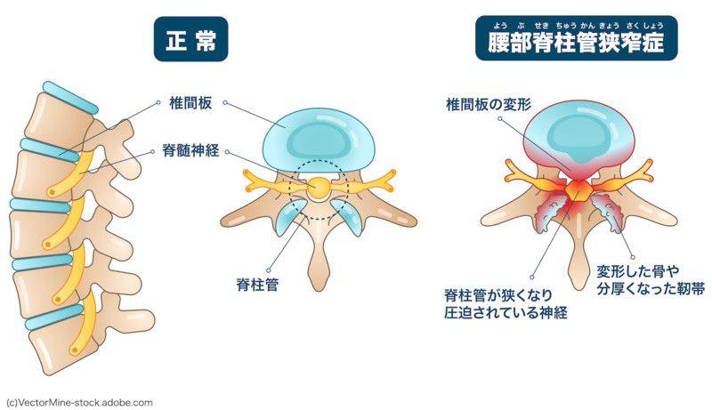 How to shave the waist