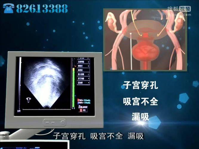 Pregnancies can be treated as pain-free