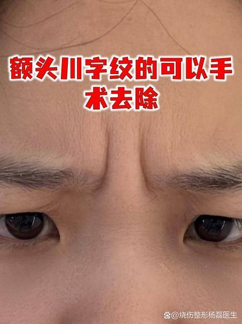 The best way to get rid of kawakawa's handwriting