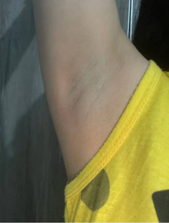 It's the most effective way to defox