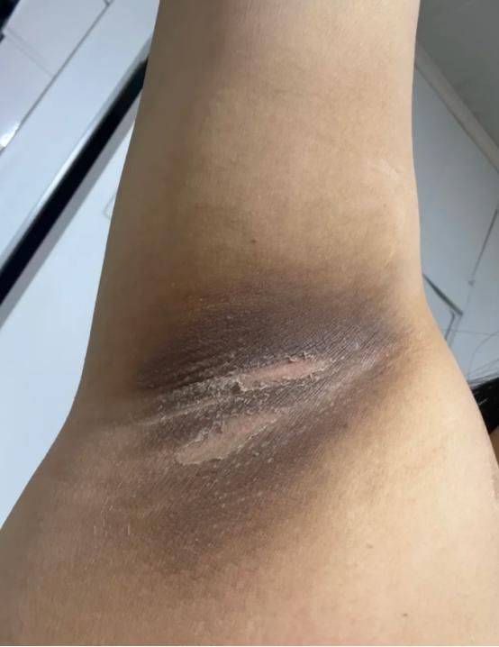 It's the most effective way to defox