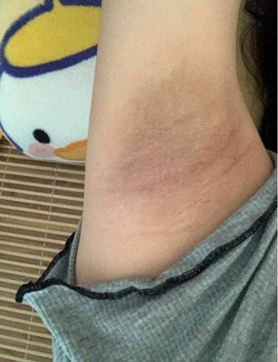 It's the most effective way to defox