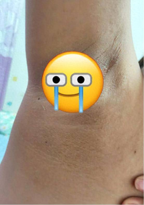 It's the most effective way to defox