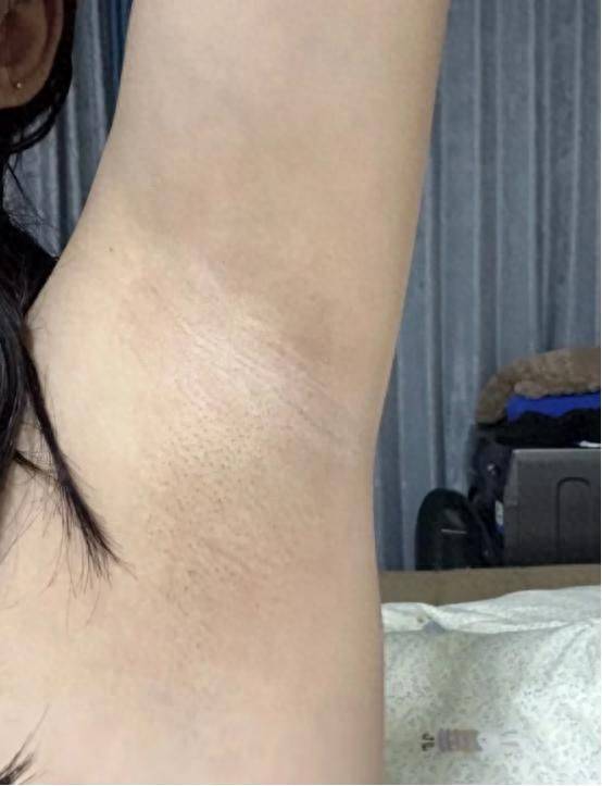 It's the most effective way to defox