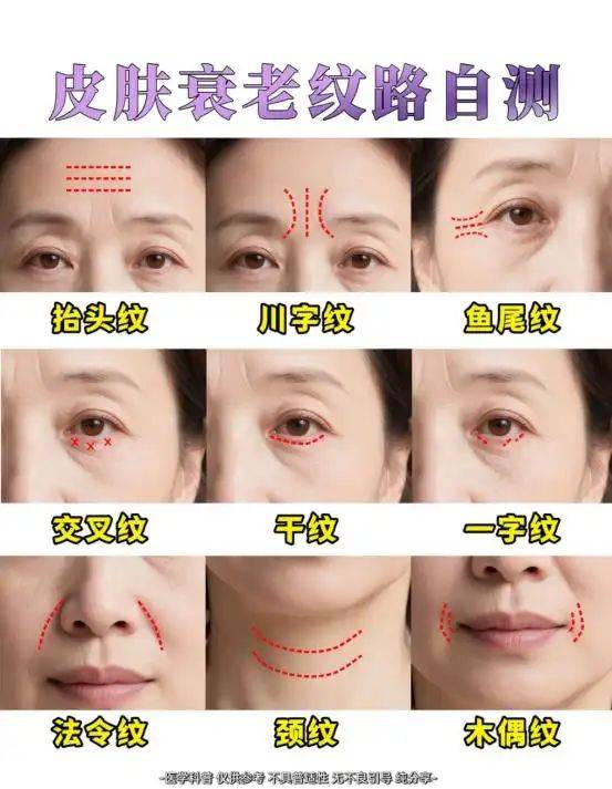 注射除皱的价钱