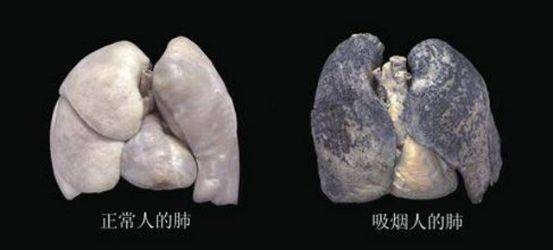 禁毒防艾知识竞赛