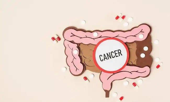 Cost of rectal cancer treatment
