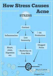 祛痘激光一次多少钱