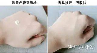 祛痘激光一次多少钱