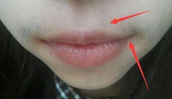 去唇毛的方法