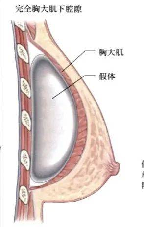 乳晕缩小整形多少钱