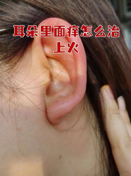 How much for fistula surgery