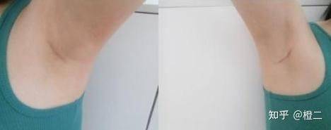 乳晕缩小整形多少钱