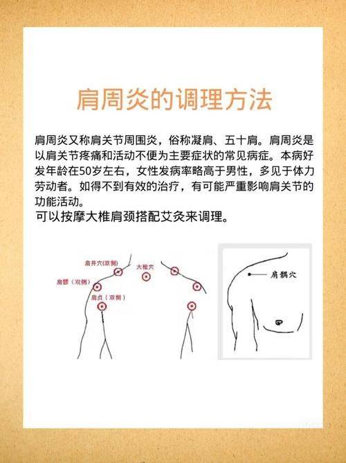 肩周炎的治疗方法