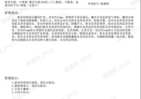 How much for fistula surgery