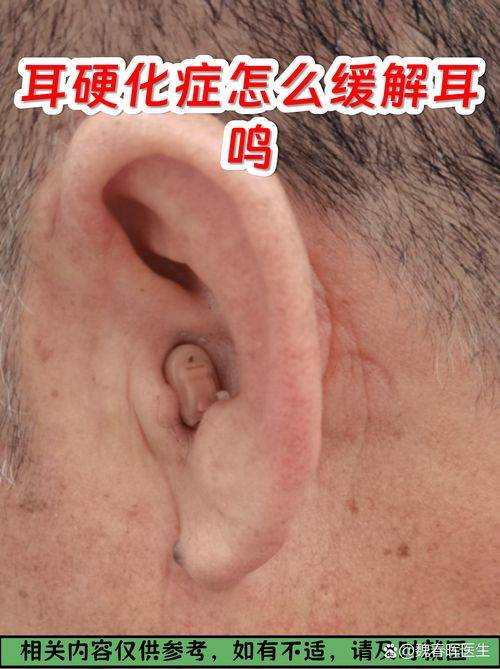 瘘管手术多少钱