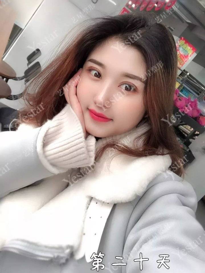 上海缝线双眼皮多少钱