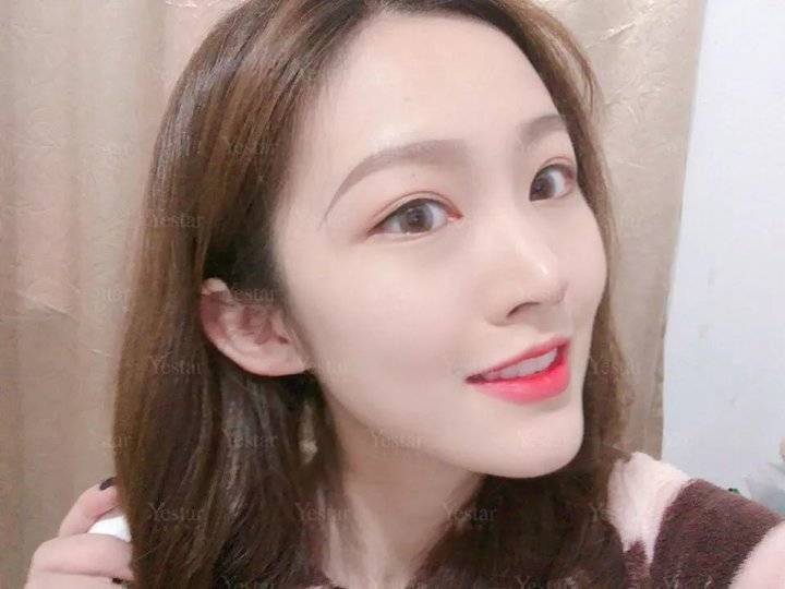 上海缝线双眼皮多少钱