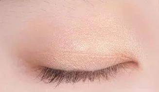 上海缝线双眼皮多少钱