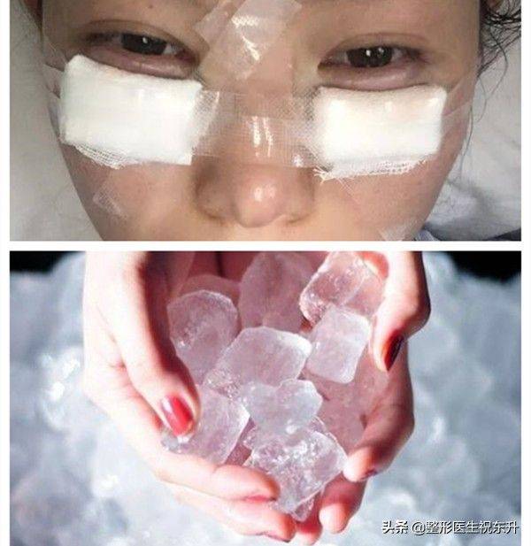 How much for eyebag surgery