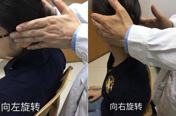 治疗颈椎病有哪些方法