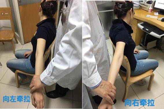 治疗颈椎病有哪些方法