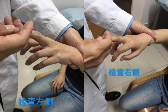 治疗颈椎病有哪些方法