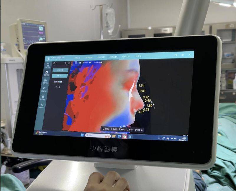 鼻头缩小 多少钱