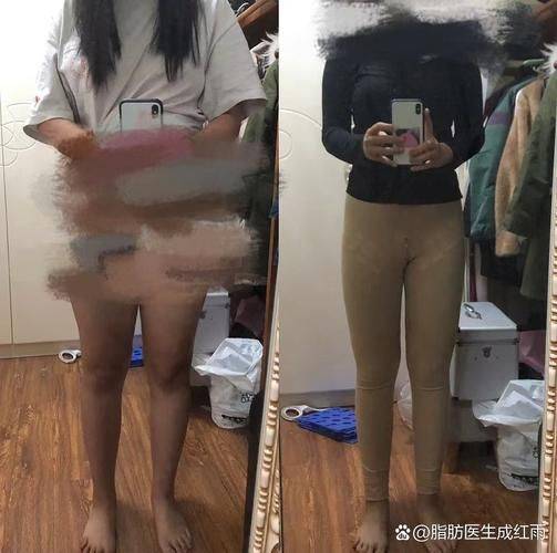 How much for abdominal fat loss