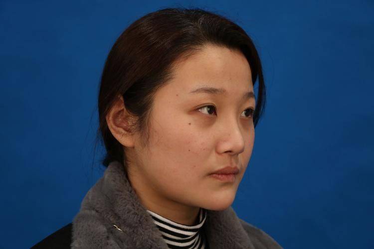 脸部激光溶脂多少钱