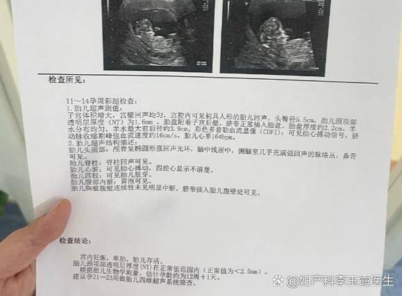 三维彩超多少钱?