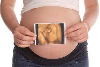 三维彩超多少钱?