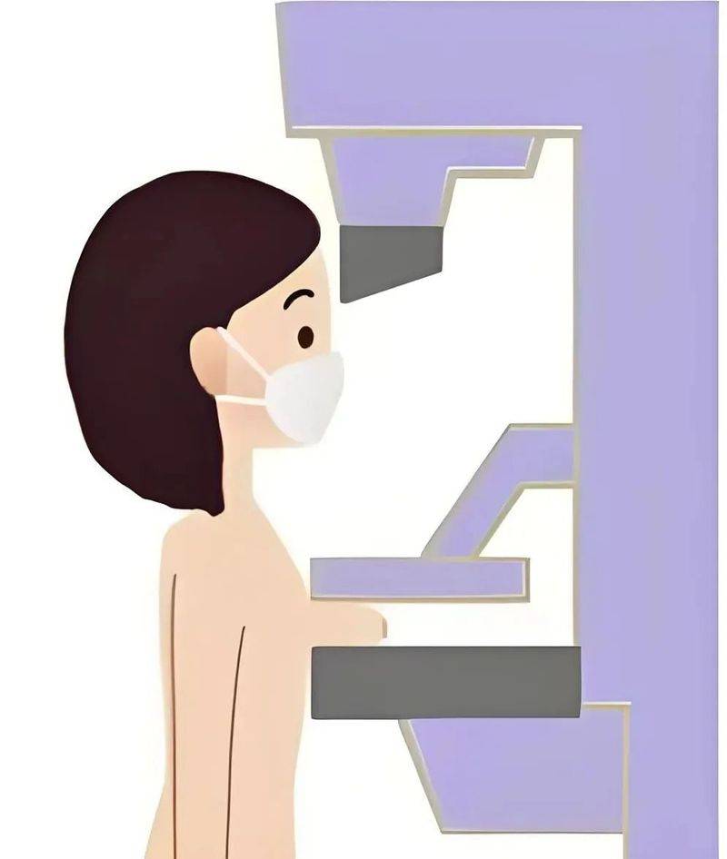 乳房钼靶检查多少钱