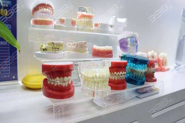 自锁牙套大概多少钱