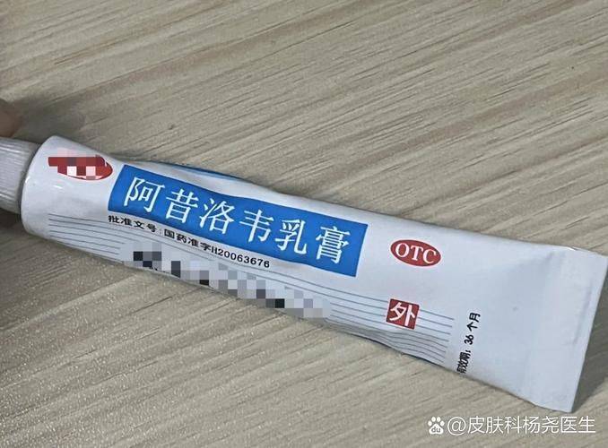 治疗体癣特效方法
