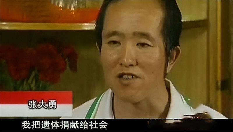 猫叫综合症成因