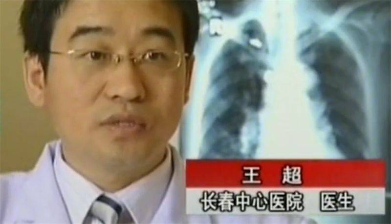 猫叫综合症成因