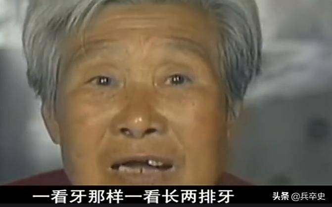 猫叫综合症成因