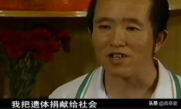 猫叫综合症成因