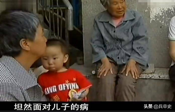 猫叫综合症成因