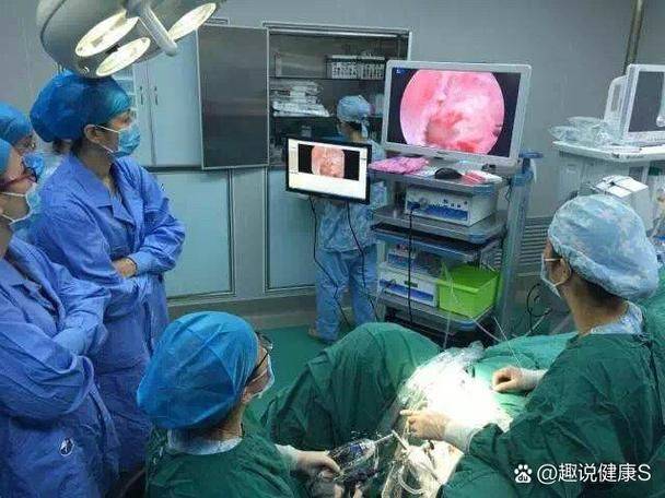How much is ankang without pain