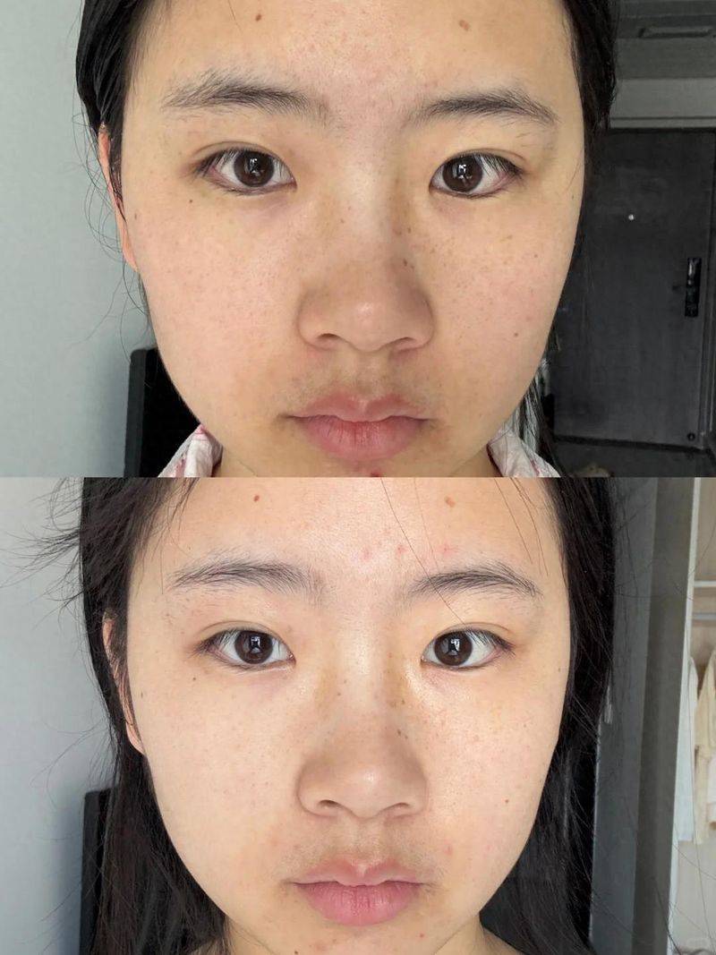容园美面膜价钱