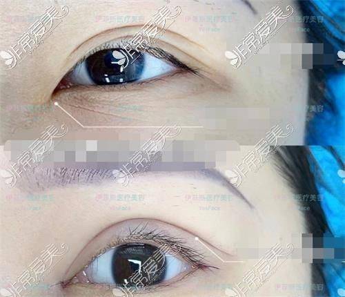 How much for nanjing plastic surgery